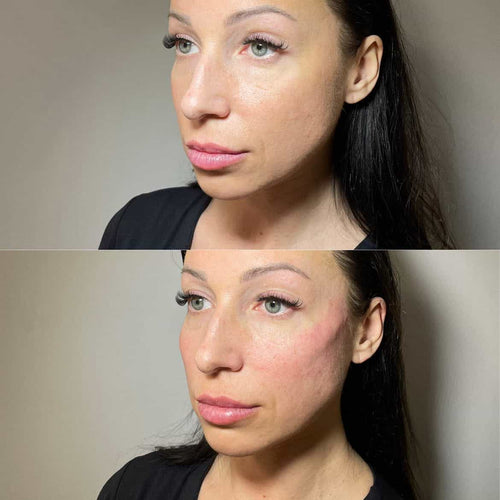 At what age does a woman's neck start to sag?