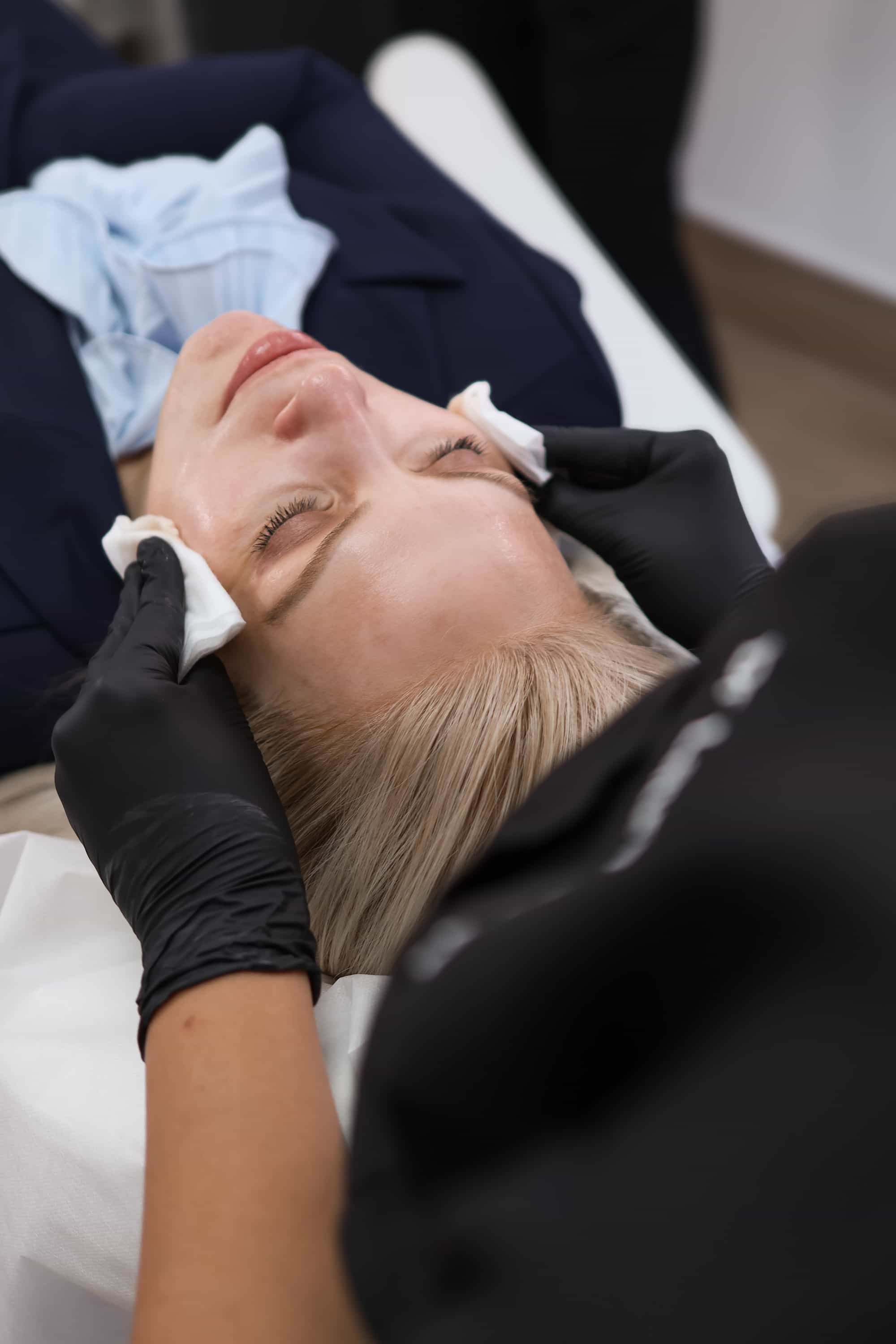 Dermal Fillers near Cheam, Surrey